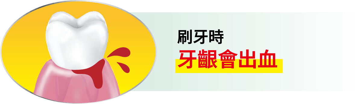 刷牙時牙齦會出血